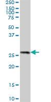 Anti-PROSC Mouse Polyclonal Antibody