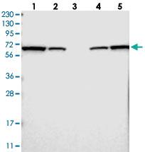 Anti-LTA4H Rabbit Polyclonal Antibody