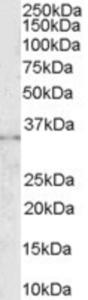 EB06695 (0.3 µg/ml) staining of K562 lysate (35 µg protein in RIPA buffer). Primary incubation was 1 hour. Detected by chemiluminescence.