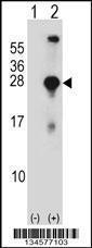 Anti-SNAP23 Rabbit Polyclonal Antibody (Biotin)