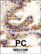 Anti-BRAF Rabbit Polyclonal Antibody