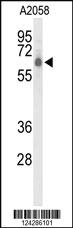 Anti-CLPTM1L Rabbit Polyclonal Antibody