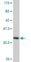 Anti-ZNF101 Mouse Monoclonal Antibody [clone: 2D5]