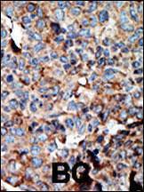 Anti-NME2 Rabbit Polyclonal Antibody (AP (Alkaline Phosphatase))