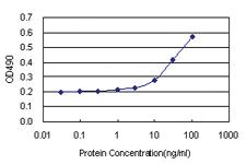 Anti-FCN1 Antibody Pair