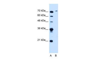 Anti-SLCO6A1 Rabbit Polyclonal Antibody