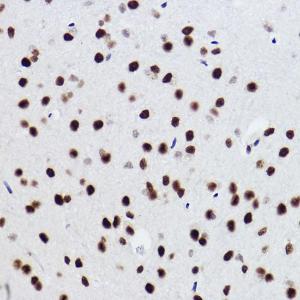 Immunohistochemistry analysis of paraffin-embedded mouse brain using Anti-BRMS1 Antibody [ARC2536] (A307654) at a dilution of 1:100 (40x lens)