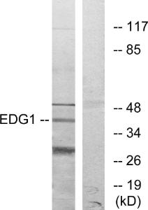 Western blot analysis of lysates from COLO205 cells using Anti-EDG1 Antibody. The right hand lane represents a negative control, where the antibody is blocked by the immunising peptide