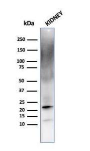 Anti-Ferritin Light Chain antibody