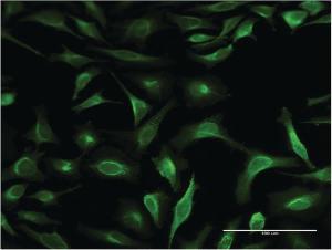 Anti-S100 P Mouse Monoclonal Antibody [clone: 1A11]