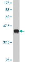 Anti-PICK1 Mouse Polyclonal Antibody