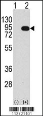 Anti-BRAF Rabbit Polyclonal Antibody