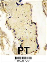 Anti-SPPL2A Rabbit Polyclonal Antibody (PE (Phycoerythrin))