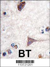 Anti-BRAF Rabbit Polyclonal Antibody