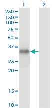 Anti-MYOG Mouse Monoclonal Antibody [clone: 2E7]