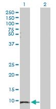 Anti-SAA1 Rabbit Polyclonal Antibody