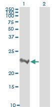 Anti-RHOA Mouse Monoclonal Antibody [clone: 1B12]