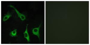 Immunofluorescence analysis of COS7 cells using Anti-EDG1 Antibody. The right hand panel represents a negative control, where the antibody was pre-incubated with the immunising peptide