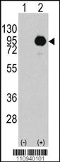 Anti-BRAF Rabbit Polyclonal Antibody