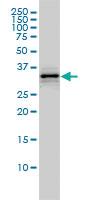 Anti-HMGCL Mouse Monoclonal Antibody [clone: 4F4-D1]