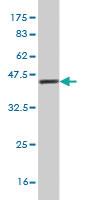 Anti-PICK1 Mouse Monoclonal Antibody [clone: 3G5]