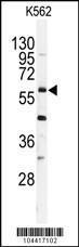 Anti-USP2 Rabbit Polyclonal Antibody (APC (Allophycocyanin))