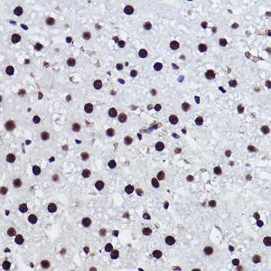 Immunohistochemistry analysis of paraffin-embedded rat liver using Anti-BRMS1 Antibody [ARC2536] (A307654) at a dilution of 1:100 (40x lens). Perform high pressure antigen retrieval with 10 mM citrate buffer pH 6.0 before commencing with IHC staining protocol