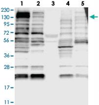 Anti-TTLL5 Rabbit Polyclonal Antibody