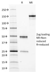 SDS-PAGE analysis of Anti-Ferritin Light Chain Antibody [FTL/1388] under non-reduced and reduced conditions; showing intact IgG and intact heavy and light chains, respectively. SDS-PAGE analysis confirms the integrity and purity of the antibody