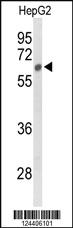 Anti-SGSH Rabbit Polyclonal Antibody