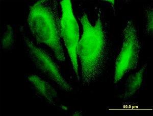 Anti-RHOA Mouse Monoclonal Antibody [clone: 1B12]