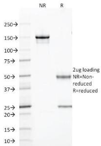 SDS-PAGE analysis of Anti-TLE1 Antibody [TLE1/2085] under non-reduced and reduced conditions; showing intact IgG and intact heavy and light chains, respectively. SDS-PAGE analysis confirms the integrity and purity of the antibody.