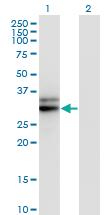 Anti-HMGCL Mouse Monoclonal Antibody [clone: 4F4-D1]