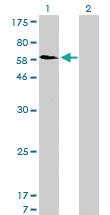 Anti-SNX1 Mouse Monoclonal Antibody [clone: 6H1]