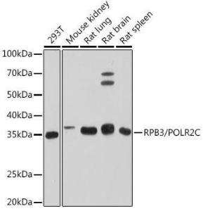 Western blot analysis of extracts of various cell lines, using Anti-RPB3 Antibody [ARC1729] (A307655) at 1:500 dilution