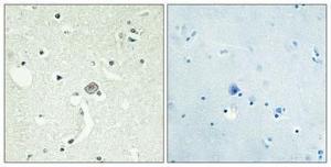 Immunohistochemical analysis of paraffin-embedded human brain using Anti-EDG1 Antibody 1:100 (4°C overnight). The right hand panel represents a negative control, where the antibody was pre-incubated with the immunising peptide