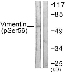 Western blot analysis of lysates from A549 cells treated with Nocodazole 1µg/ml 16h using Anti-Vimentin (phospho Ser56) Antibody. The right hand lane represents a negative control, where the antibody is blocked by the immunising peptide.