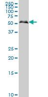 Anti-SMAD1 Mouse Monoclonal Antibody [clone: 2E9]