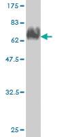 Anti-ACTA2 Mouse Monoclonal Antibody [clone: 4A8-2H3]