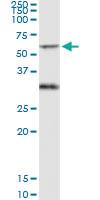 Anti-PICK1 Polyclonal Antibody Pair