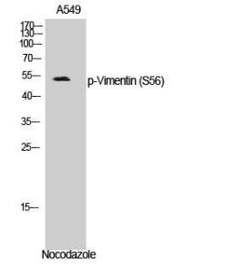 Western blot analysis of A549 cells using Anti-Vimentin (phospho Ser56) Antibody