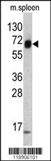 Anti-KRT4 Rabbit Polyclonal Antibody