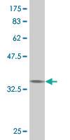 Anti-RPS6KB1 Mouse Monoclonal Antibody [clone: 2C2]