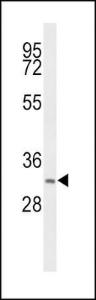 Anti-HSD17B12 Rabbit Polyclonal Antibody (AP (Alkaline Phosphatase))