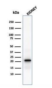 Western blot analysis of human kidney tissue lysate using Anti-Ferritin Light Chain Antibody [FTL/1388]