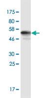 Anti-AKR1E2 Mouse Monoclonal Antibody [clone: 1C8]