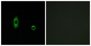 Immunofluorescence analysis of A549 cells using Anti-CXG2 Antibody The right hand panel represents a negative control, where the antibody was pre-incubated with the immunising peptide