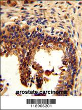 Anti-KRT4 Rabbit Polyclonal Antibody