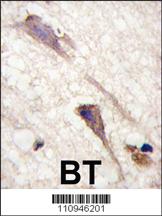 Anti-BRAF Rabbit Polyclonal Antibody