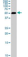 Anti-SMAD1 Mouse Monoclonal Antibody [clone: 2E9]